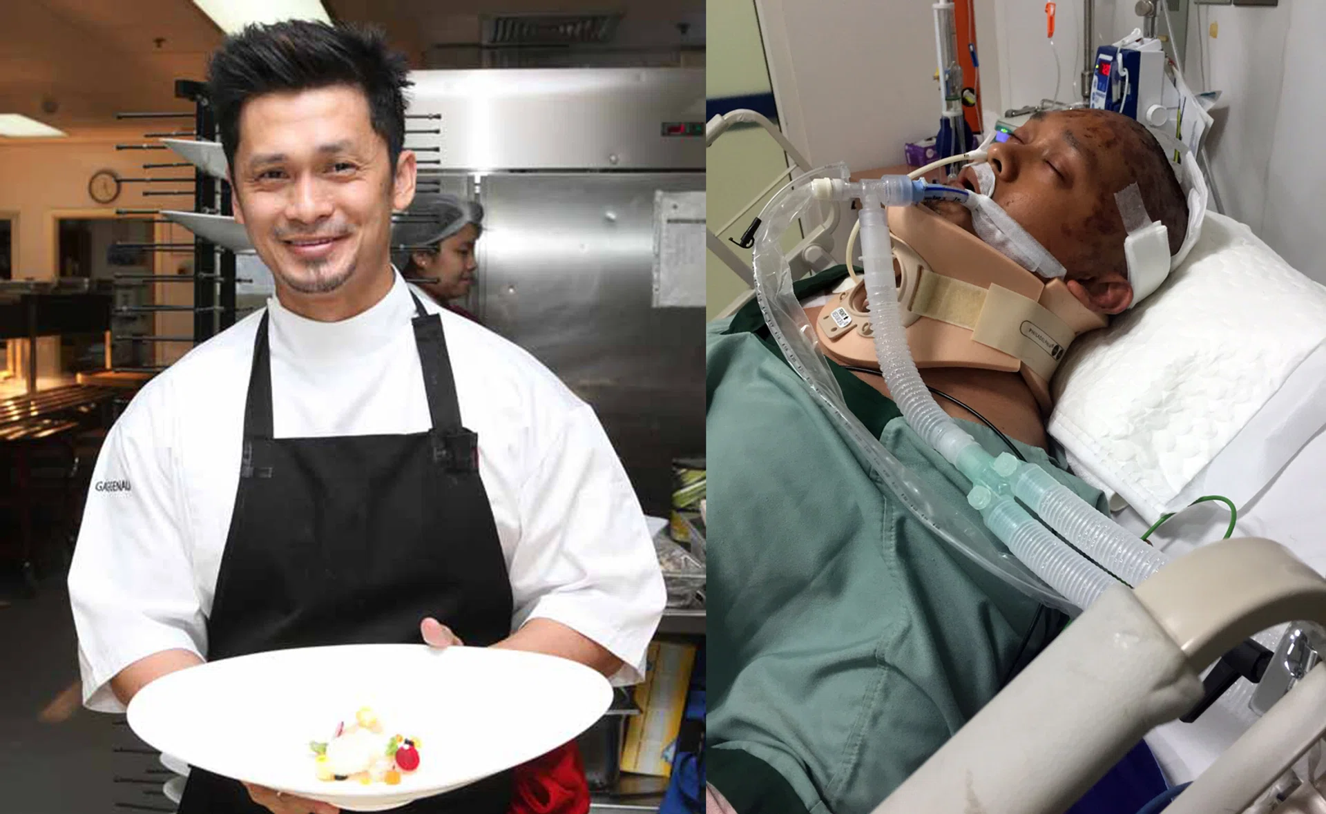 BEFORE & AFTER: (Left) Mr Muhammad Haikal Johari working as a chef in Bangkok and when he was in hospital after the accident (right).