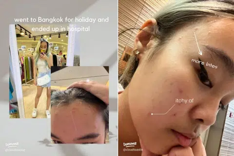 Still awaiting compensation 3 months after getting bit by bugs at Bangkok hotel