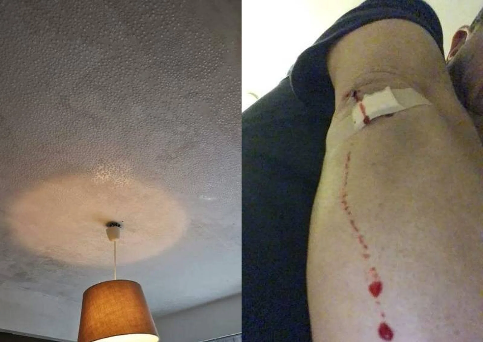 The dripping condensation from the ceiling made the floor slippery, causing Mr Wang to fall and suffer a cut.