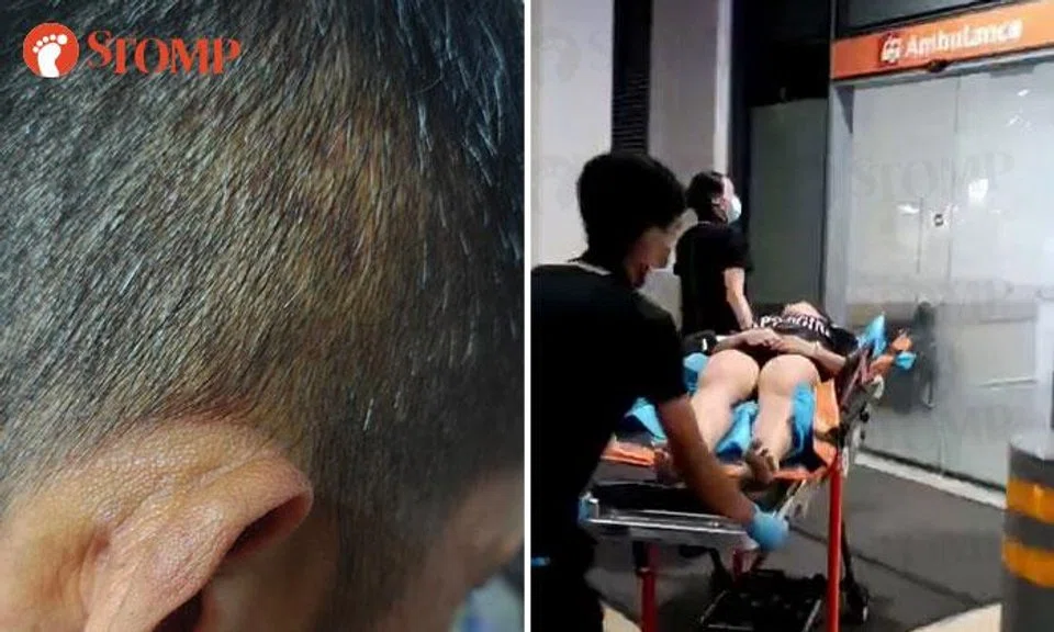 Mr Chen with visible bruises and paramedics attending to Ms Chen.