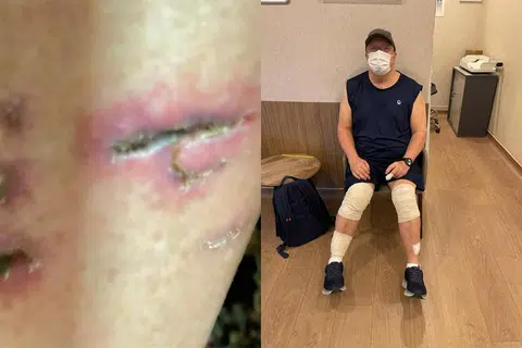 Otter attack leaves man with more than 20 wounds