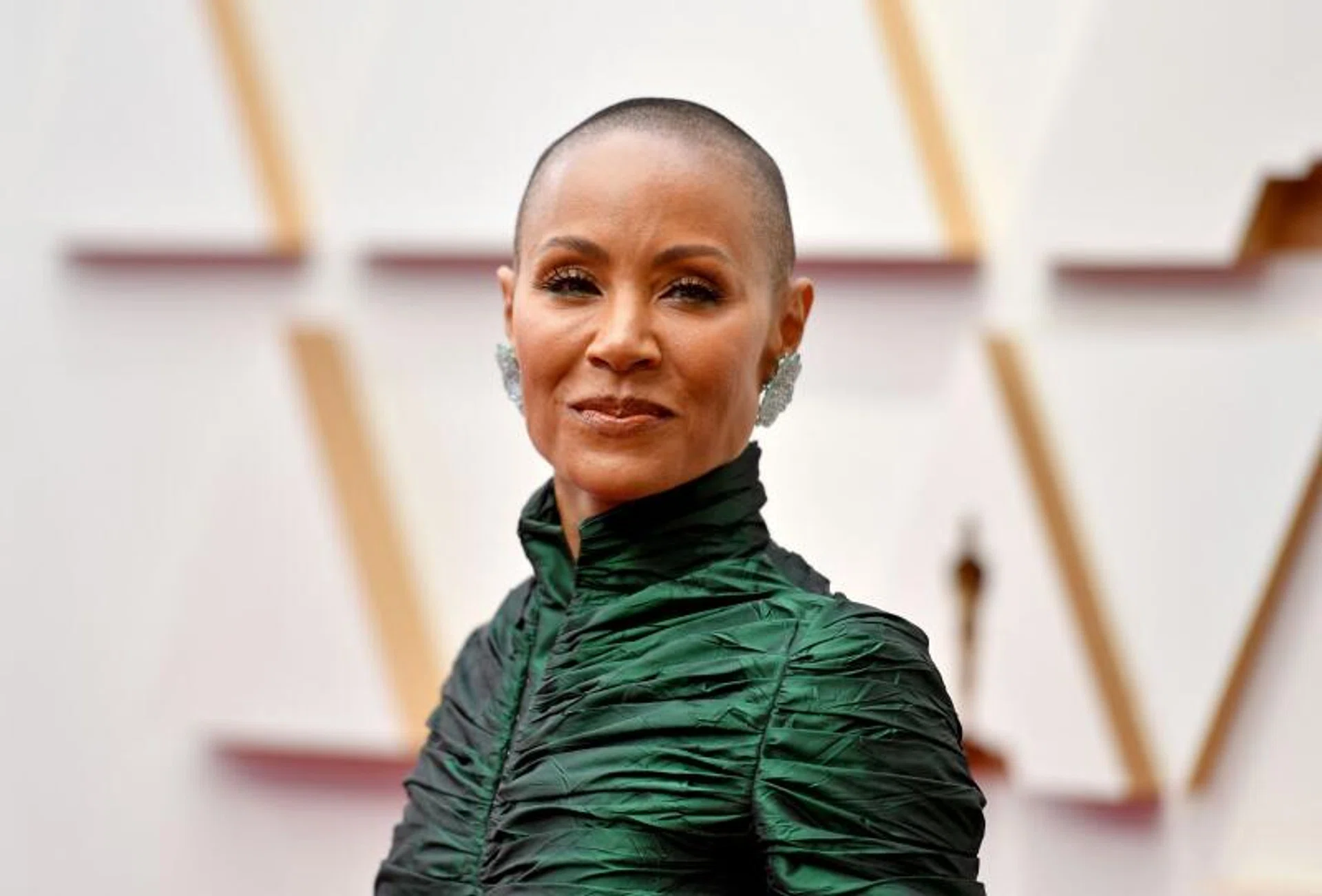 Jada Pinkett Smith spoke out for the first time in 2018 about her diagnosis of alopecia, a medical term referring to the loss of hair.