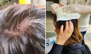 Durian splits open after falling on woman's head at Pulau Ubin