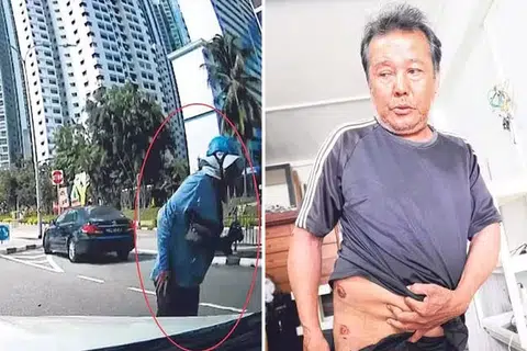 Delivery rider fractures pelvis in accident with 2 Mercedes