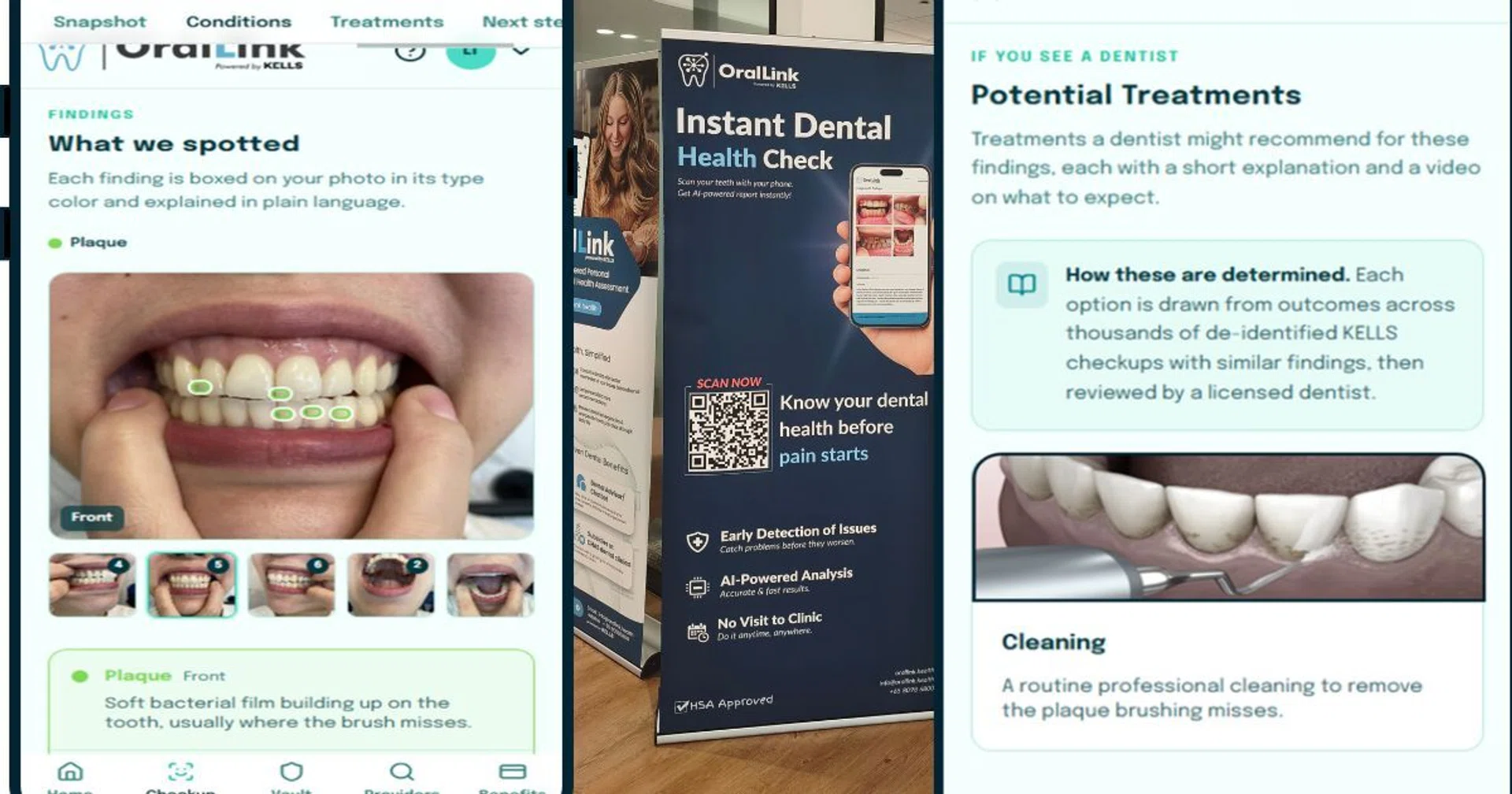 Oral Link