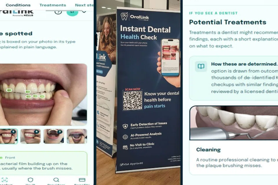 Oral Link