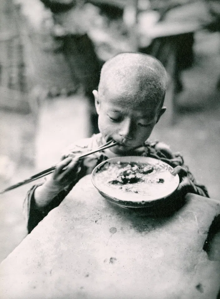 A child receiving relief aid.