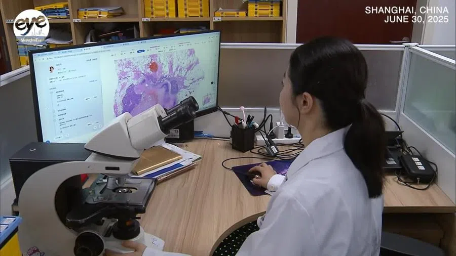A screen shot from a video featuring a medical staff looking at images from the RuiPath AI system at Ruijin Hospital. (Internet)