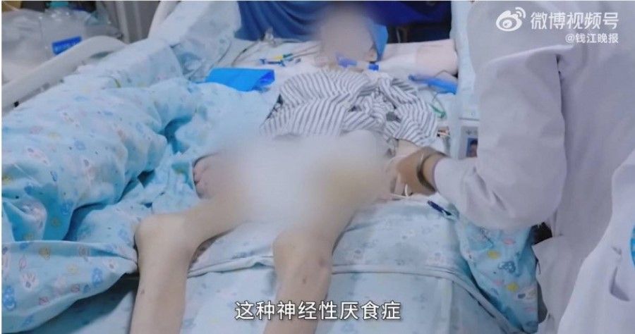A 15-year-old Chinese girl weighed less than 25kg when she died after developing anorexia nervosa. (Internet)