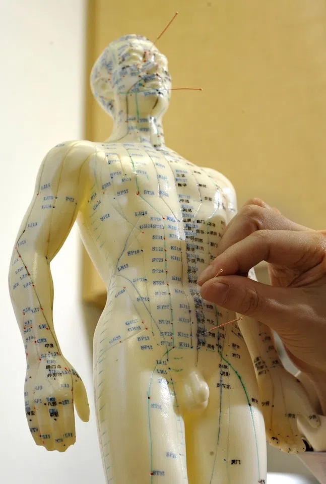 A figurine template marked with meridians and acupoint locations for acupuncture purposes. (SPH)