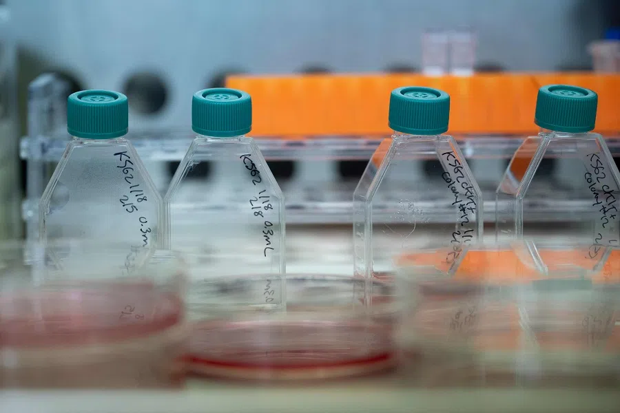 Cell lines are prepared in the laboratory of Dr. John Tisdale, a Senior Investigator at the National Heart, Lung, and Blood Institute’s Cellular and Molecular Therapeutics Laboratory, at the National Institutes of Health on 8 February 2024, in Bethesda, Maryland, US.  (Brendan Smialowski/AFP)