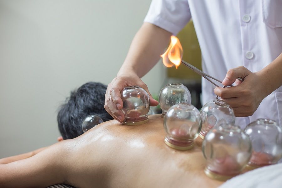 Cupping therapy is another means of stimulating acupoints. (iStock)