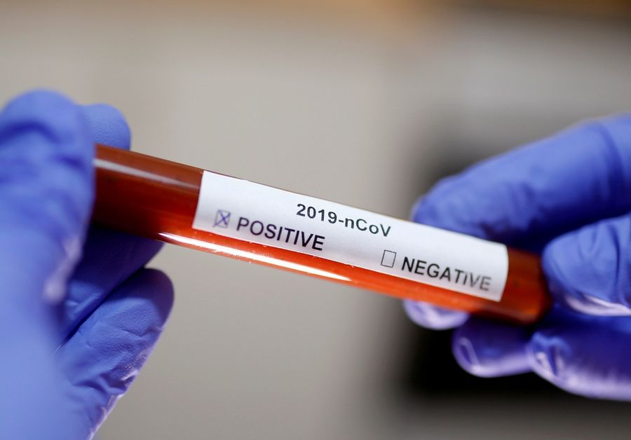 A test tube with the coronavirus label is seen in this illustration taken on 29 January 2020. (Dado Ruvic/File Photo/Reuters)