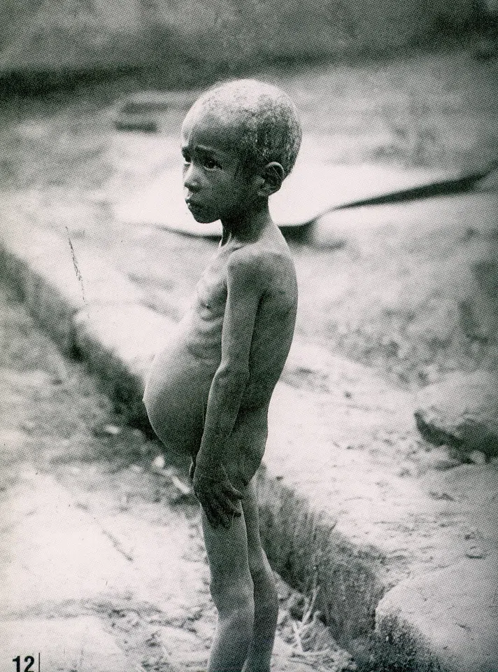 A child during the Sichuan famine.