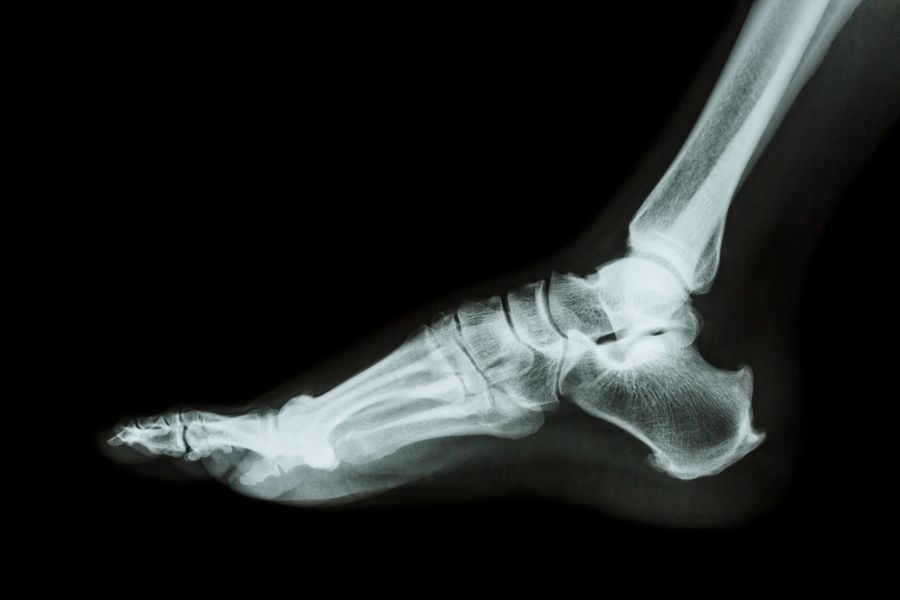 My first experience with the healthcare system in China was in Shenzhen when I discovered a growth on my left foot which was starting to affect my mobility. (iStock)