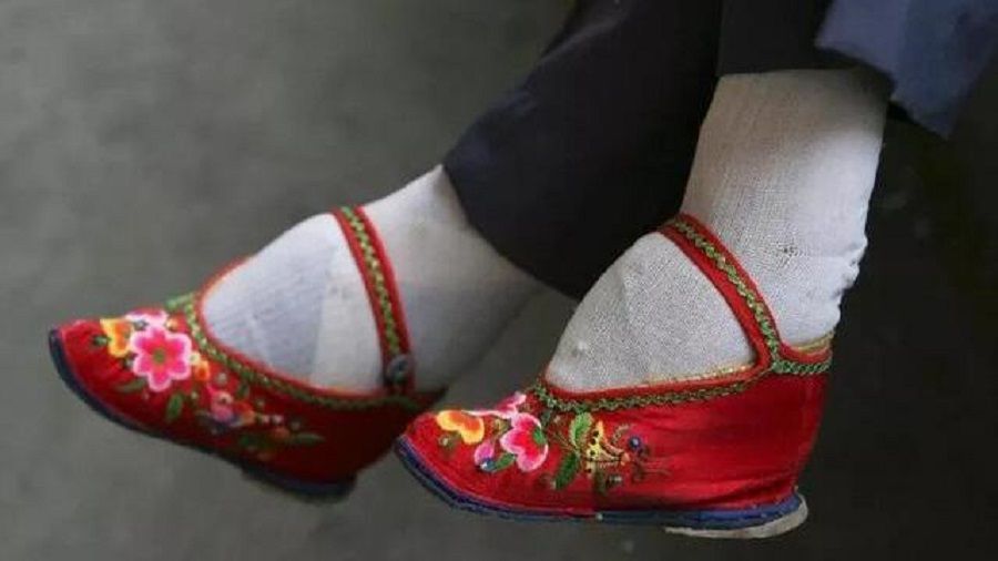 The ancient tradition of foot binding. (Internet)