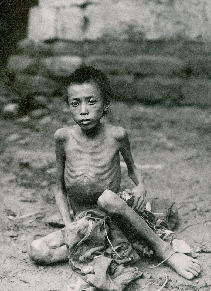 In 1937, famine in southern Sichuan left children in the disaster areas emaciated.