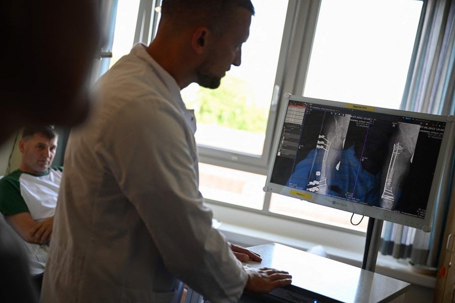 A physician examines x-ray photographs at the Campus Virchow Clinic in Berlin, Germany, on 12 June 2023. (Tobias Schwarz/AFP)