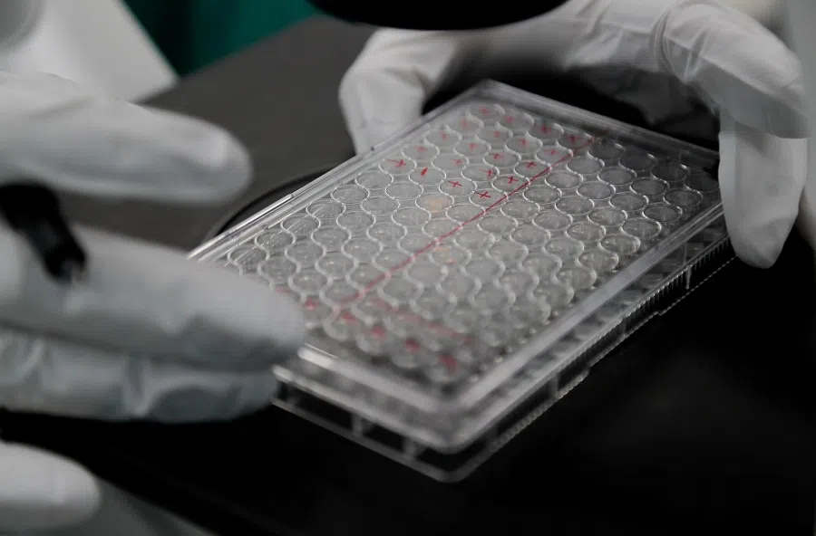 A scientist examines Covid-19 infected cells during research for a vaccine against the coronavirus at a laboratory in Saint Petersburg, Russia, on 20 May 2020. (Anton Vaganov/File Photo/Reuters)