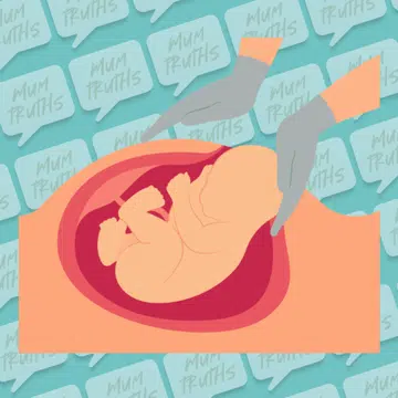 elective c-section singapore mum pov no regrets