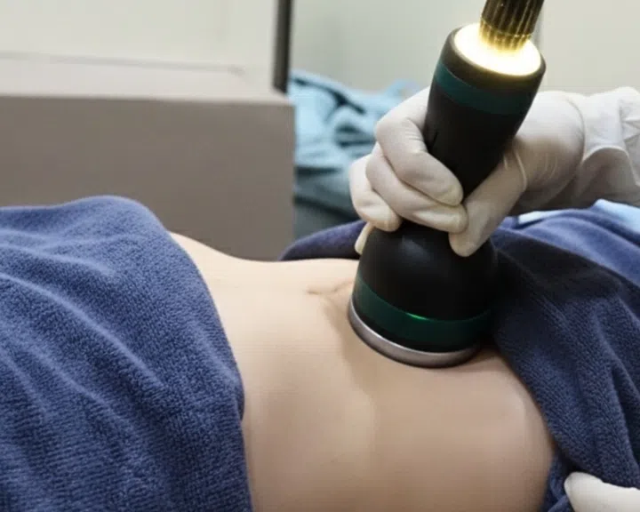 Onda Pro Lift and Sculpt, Illuminate Medispa Dempsey