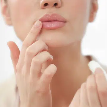 Your Dry, Cracked And Itchy Lips Could Be Due To Cheilitis