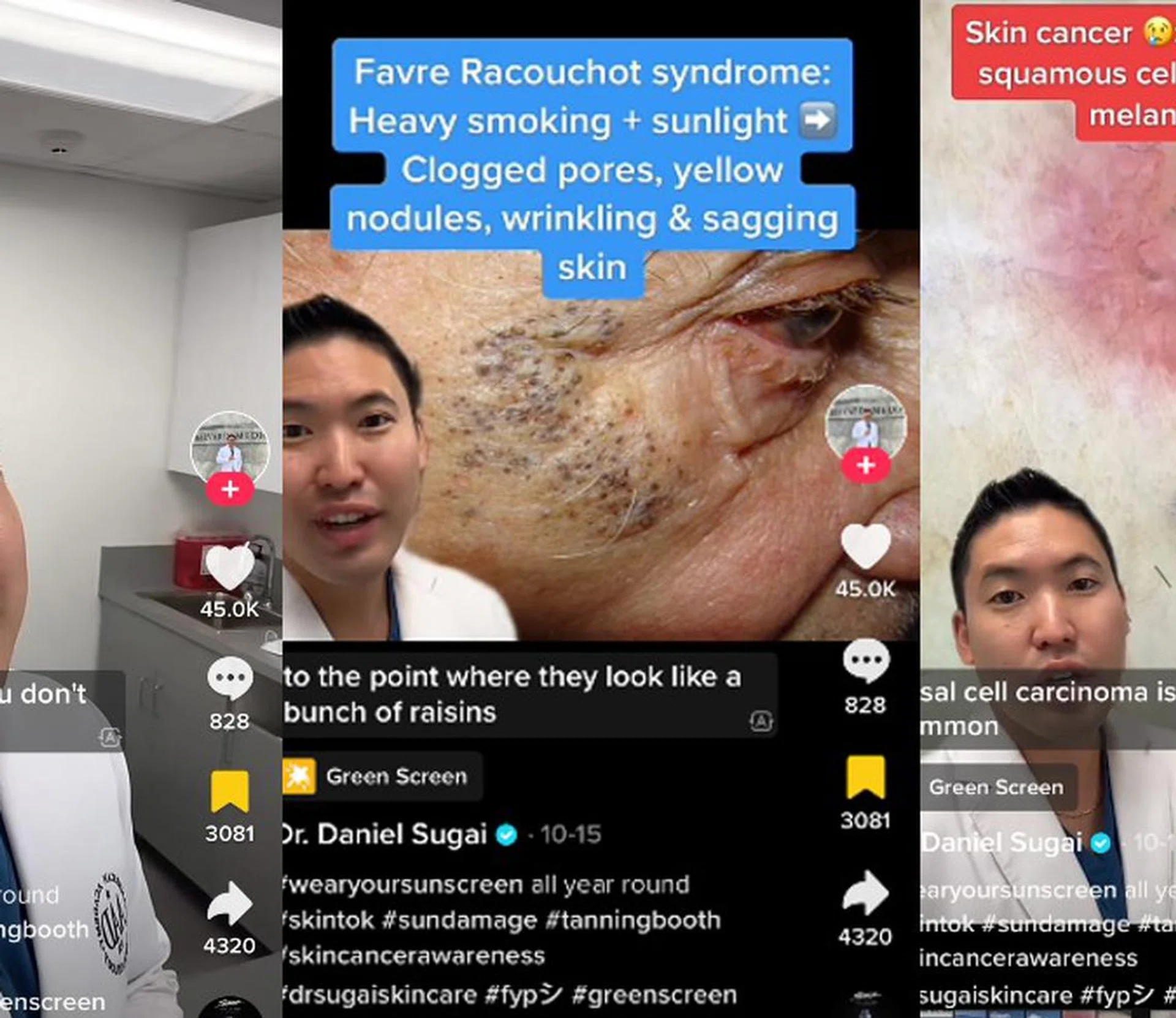 A Harvard Dermatologist Shows What Will Happen To Your Skin Without Sunscreen