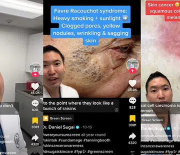 A Harvard Dermatologist Shows What Will Happen To Your Skin Without Sunscreen