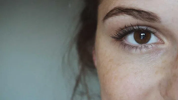 Fractional laser treatment helps nix pigmentation, stimulate collagen and shrink the appearance of pores in as little as one session.