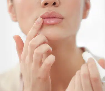 Your Dry, Cracked And Itchy Lips Could Be Due To Cheilitis