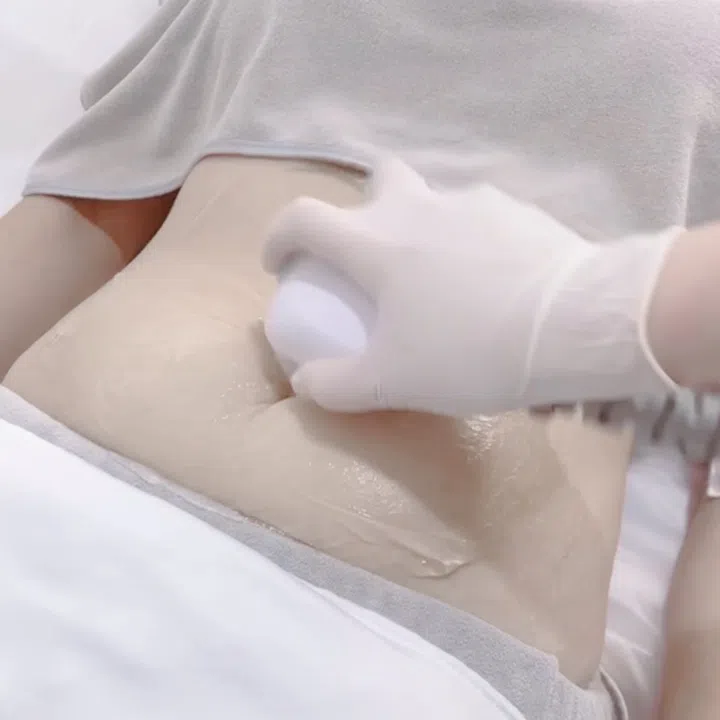 EndyMED Body Firming Treatment, Cheongdam Body & Wellness