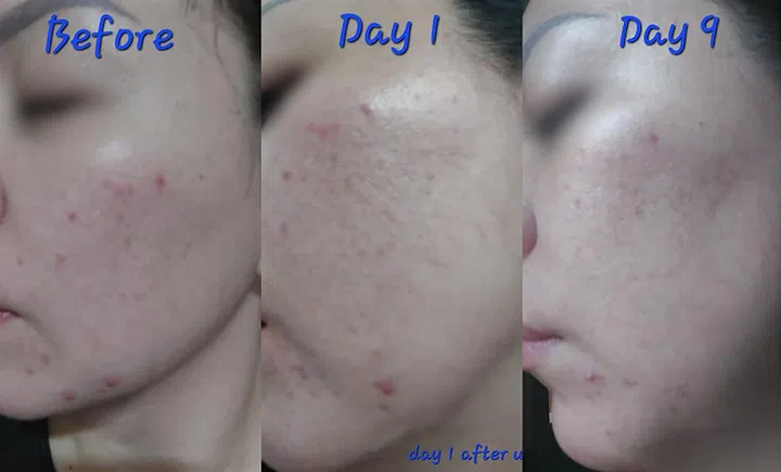 The Power of Probiotics Why Netizens Can’t Stop Raving About This Face Cleanser Magdalene