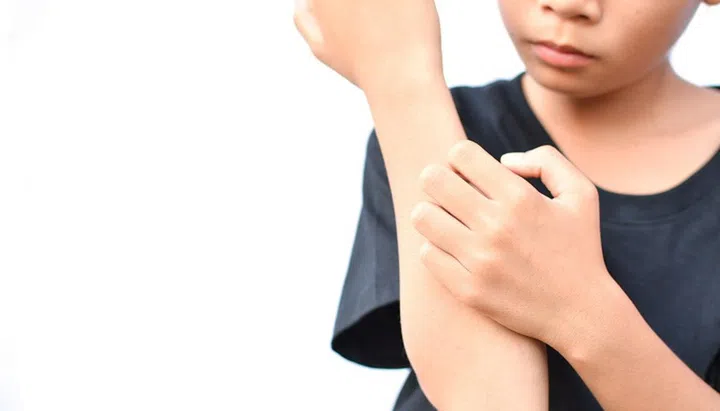 little Asian girl scratch itch hand on white background