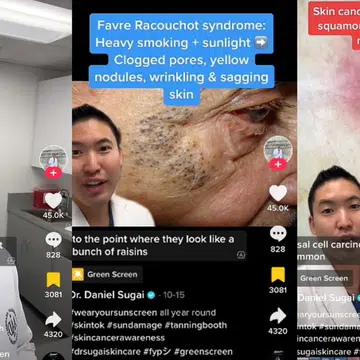 A Harvard Dermatologist Shows What Will Happen To Your Skin Without Sunscreen