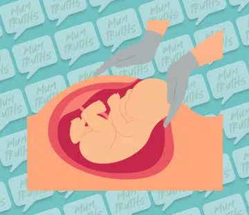 elective c-section singapore mum pov no regrets