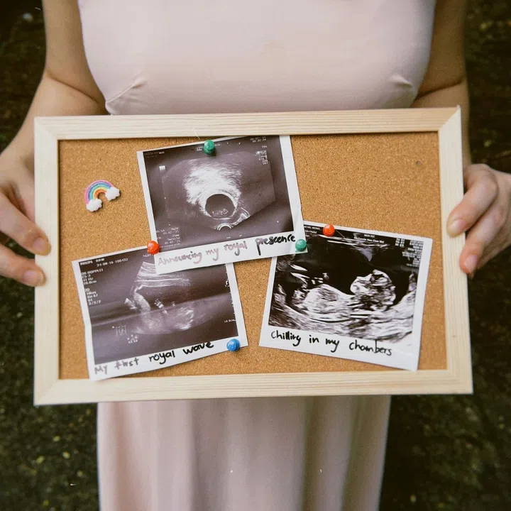 unexplained infertility at 29 - rebecca rachel wong