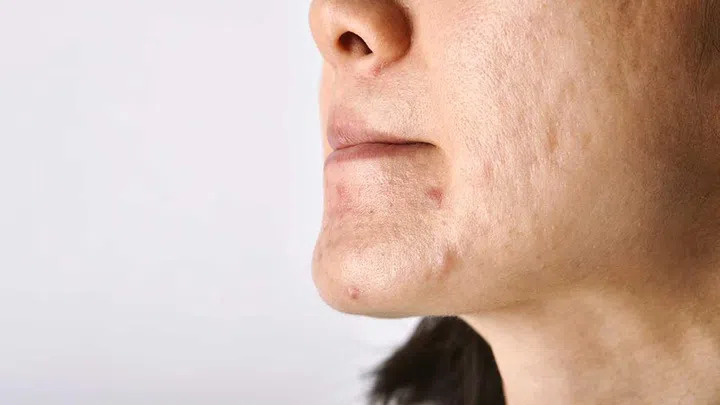 Before hitting the beauty counter, find out your skin type – combination, oily, normal, or dry – this will help you settle on the type of products you're looking for.