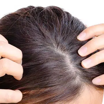 Is the hot weather giving you dandruff and sweaty, itchy, and irritated scalp? Here are 8 of the highest rated dandruff shampoos to try out