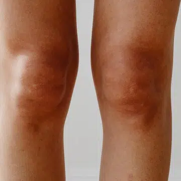 6 ways to age-proof your knees featured