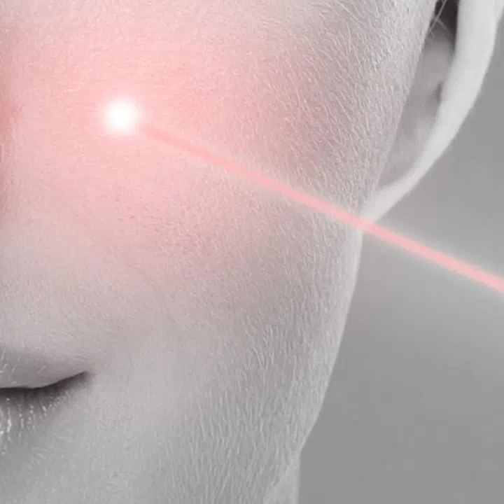 Doctor removing moles using laser ray. Beauty portrait of a young woman. Birthmark removal, plastic surgery, skin lifting and aesthetic medicine.