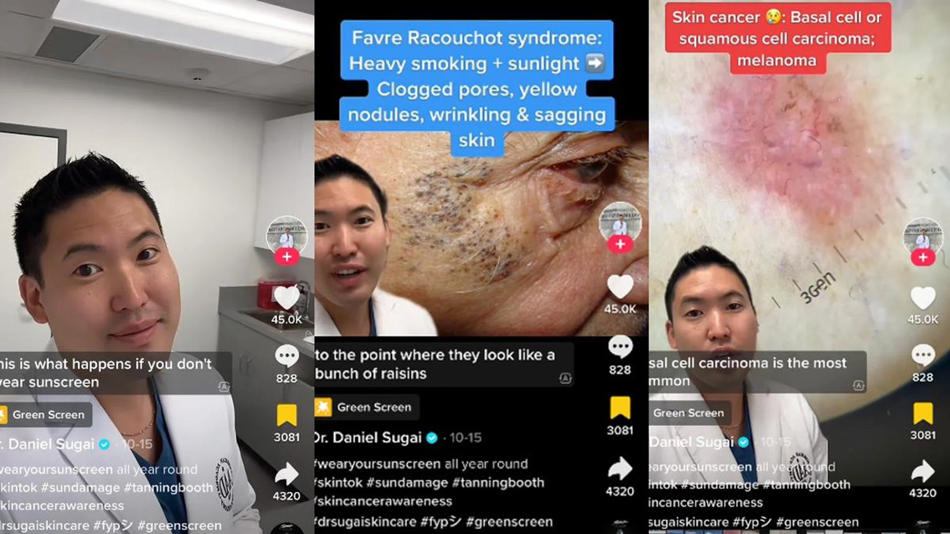 A Harvard Dermatologist Shows What Will Happen To Your Skin Without Sunscreen