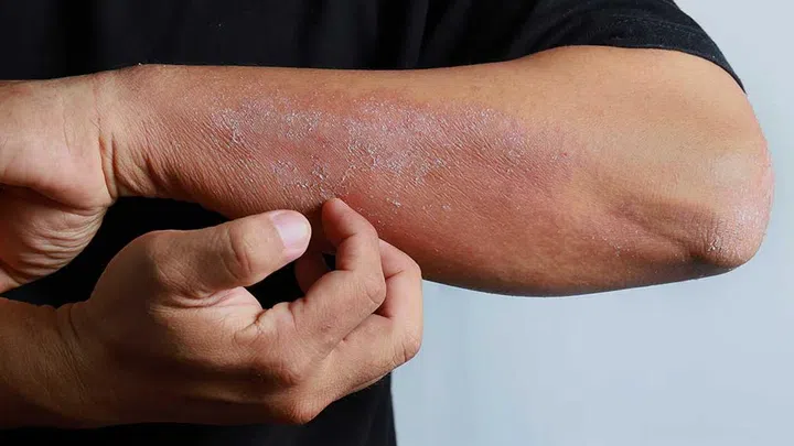 If you have eczema, you'd want to use optimal ingredients to keep the skin slightly acidic.