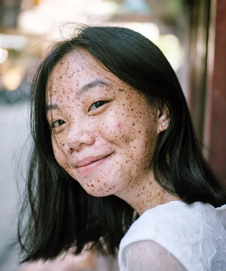 According to HBO Max's documentary series, "Not So Pretty", we often think of our skin as a barrier. However, it isn't. Pexels/ Photo by Ike louie Natividad
