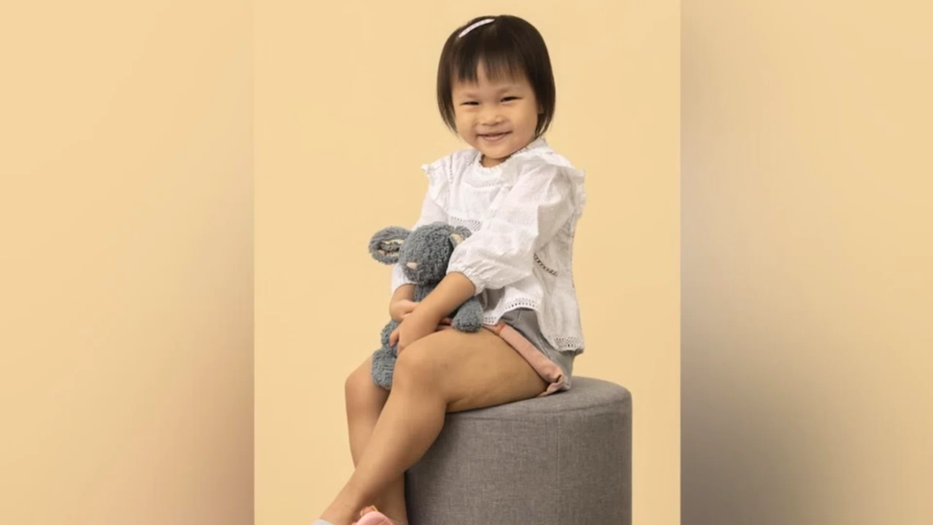 Before Cassie Chow, now five, was born, it was already obvious from pregnancy scans that her left leg was much bigger than her right.PHOTO: THE RARE SKIN CONDITIONS SOCIETY (SINGAPORE) AND DEBRA (DYSTROPIC EPIDERMOLYSIS BULLOSA RESEARCH ASSOCIATION)