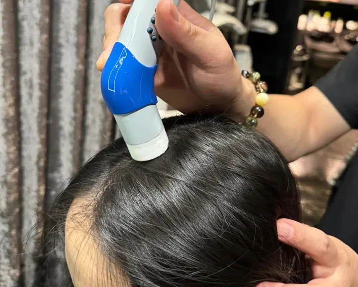 Best Non-Invasive Hair Restoration Treatment, The Signature SEP, Papilla by Kim Lim