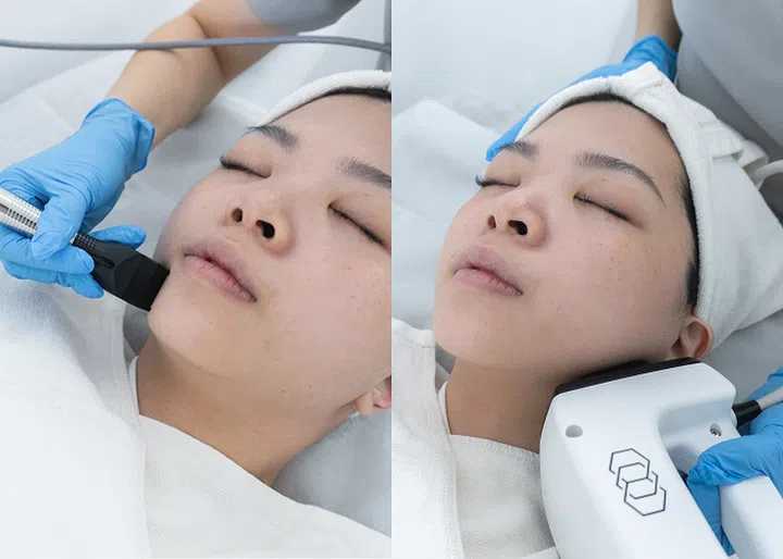 cheongdam-inmode-lifting-facial-treatment-spa-awards-winner-1