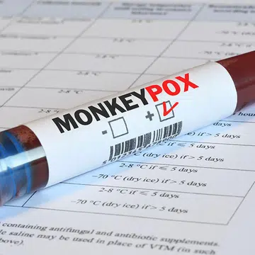 monkeypox