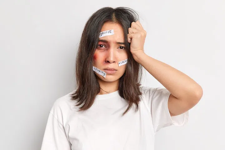 Frustrated young woman has awful moment of life bruises on face after being hurt by cruel person becomes victim of violence or racist attack stands offended against white background. Help me