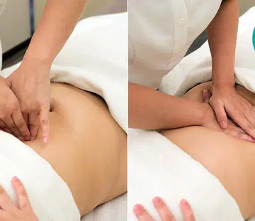 best-postnatal-slimming-treatment-mng-aesthetics