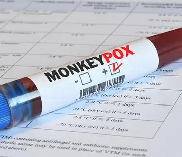 monkeypox